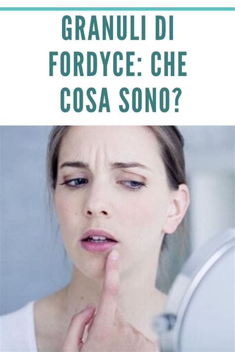 i granuli di fordyce|Granuli di Fordyce: Cause e Cure Efficaci